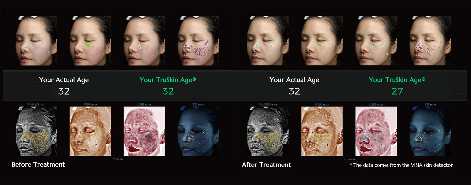 age comparison chart